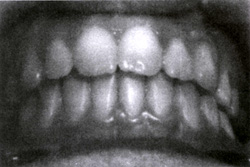 گاز طبيعى