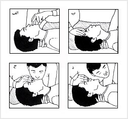 نحوهٔ عمليات احياء از طريق تنفس دهان به دهان
