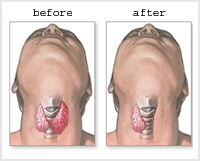 See the source image