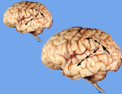 دو دستگاه بینائی مغز. پیکان‌هائی که از پشت مغز به قسمت فوقانی آن می‌روند نمودار دستگاه مکان‌یابی، و پیکان‌هائی که از پشت مغز به قسمت تحتانی مغز می‌روند نمودار دستگاه بازشناسی هستند (میشکین - Mishkin، آنگرلیدر - Ungerleider و ماکو - Macko در ۱۹۸۳).
