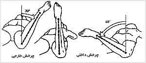چرخش خارجي، حالت بدون چرخش و چرخش داخلى استخوان ران