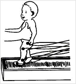 نوار متحرک مى‌تواند قدم برداشتن (رفلکس راه رفتن) طفلى را که رفلکس او ناپديد شده است دوباره ظاهر سازد