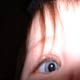 درمان بیماری‌های چشم كودكان قبل از شش سالگی امكان پذیر است