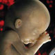 اختلالات ژنتیکی، عامل۶۰ درصد سقط جنین‌ها است