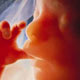 سقط جنین و كندذهنی نوزادان، از عوارض كمبود ید