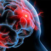 موفقیت دانشمندان در بازسازی مغزهای پیر با تزریق خون جوان!!