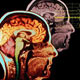 ابداع اولین اسکنر مغزی دوگانه در جهان