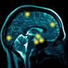 دقت ساعت مغز با افزایش سن کاهش می‌یابد