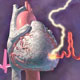 تحلیل رفتن استخوان‌ها با بروز نارسایی قلبی مرتبط است
