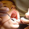 شیوع فلوئوروزیس دندانی در پسرها شدت بیشتری دارد