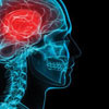 یافته‌های جدید محققان درباره صدمات ناشی از ضربه مغزی در كودكان