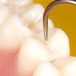 دندان‌های کمی زرد نسبت به دندان‌های سفید استحکام بیشتری دارند