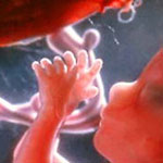 سهم مردان در سقط‌های مکرر جنینی چقدر است؟