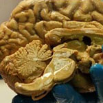 جدیدترین کشف دانشمندان درباره مغز انسان