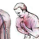 درد قفسه سینه یا کوتاه شدن نفس از علایم حمله قلبی خاموش