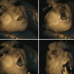 تصاویر سه‌بعدی خارق‌العاده از تکامل توانایی جنین در لمس صورت خود