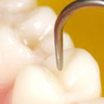 جزییات پوشش بیمه‌ای خدمات دندانپزشکی اعلام شد