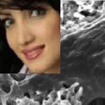 افزایش شانس موفقیت کاشت دندان در لثه با راهبرد محقق ایرانی