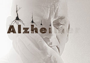 پزشکان چگونه آلزایمر و شدت آن را تشخیص می‌دهند؟