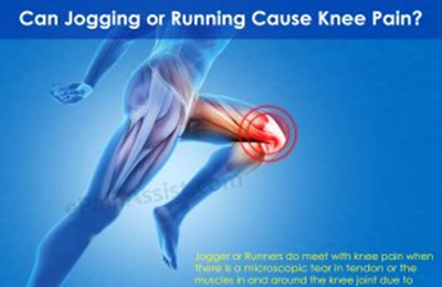 اثر دویدن بر سلامت زانو
