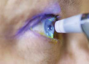ابتلابه ۴ نوع بیماری چشمی با افزایش سن