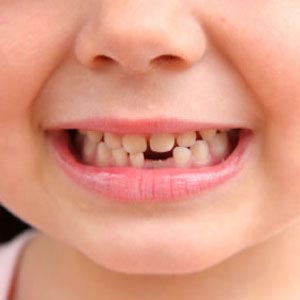 دندان کودکان از کی مراقبت می‌خواهد؟