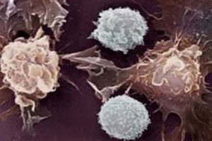 رابطه میان قرص ضدبارداری با سرطان سینه