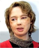 ۶ فوریه ۲۰۰۶ ـ عکس نخستین زن «چهره پیوندی» که با صورت زن دیگر زندگی می کند