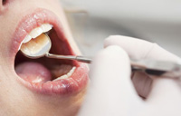 لیستی از مشکلات رایج دهان و دندان