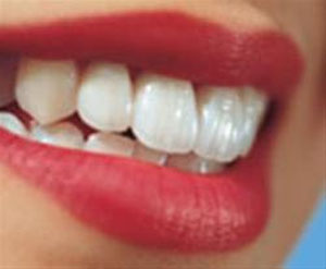 رنگ لثه مزاج دندان را نشان می‌دهد