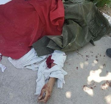 گزارش تصویری: اجساد تروریست ها/ جنازه عاملان عملیات تروریستی در تهران+ عکس 18+