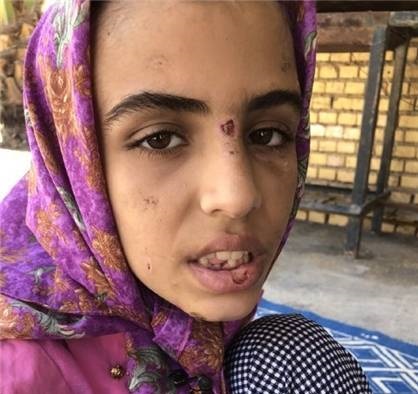 جزییات ماجرای کودک آزاری در ماهشهر | حضانت 3 کودک ماهشهری، دوباره به پدر و نامادری می رسد؟!