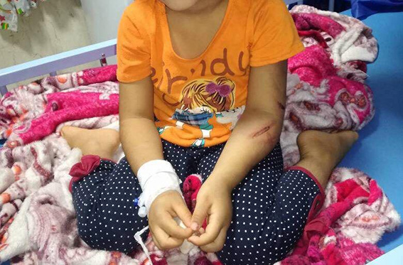  شکنجه دختر یتیم 4 ساله با کابل برق توسط عمویش
