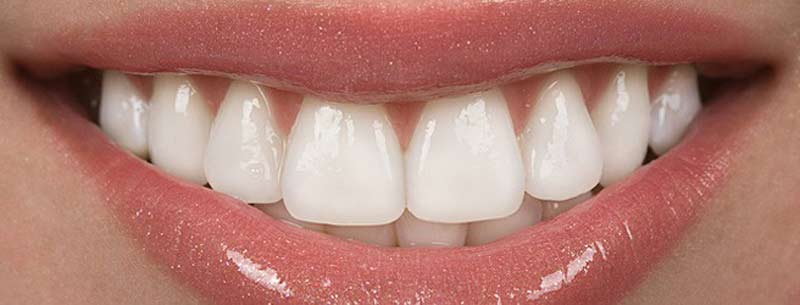 چگونه دندان های سفید و سالمی داشته باشیم