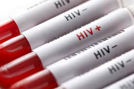 درمان قطعی یک بیمار مبتلا به ایدز در انگلستان
