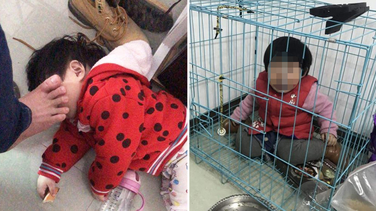  جنجال عکس تکاندهنده از کودک 20 ماهه 