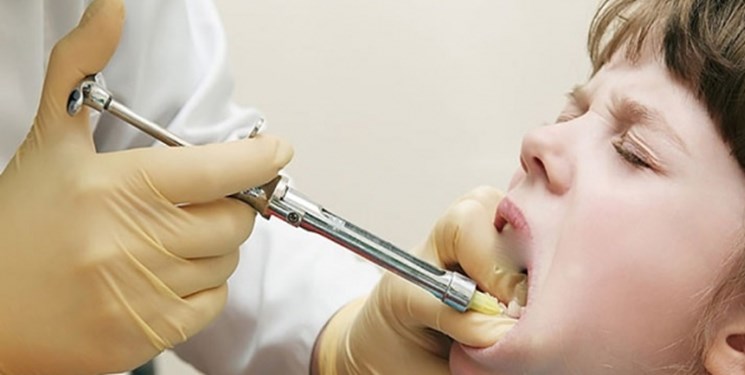عوارض کشیدن زودرس دندان شیری