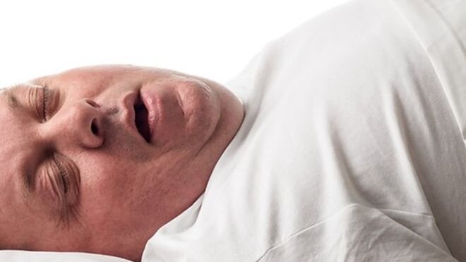 زبان پرچربی ممکن است علت اصلی وقفه تنفس در خواب باشد