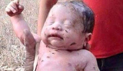 این نوزاد هفت ماهه زنده به گور شد اما زنده ماند +تصاویر