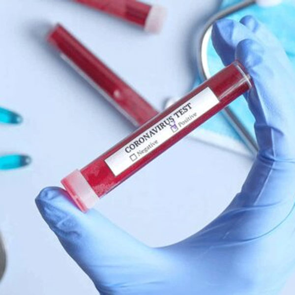 رکورد قربانیان کرونا باز هم شکست: این بار ۲۲۱ نفر