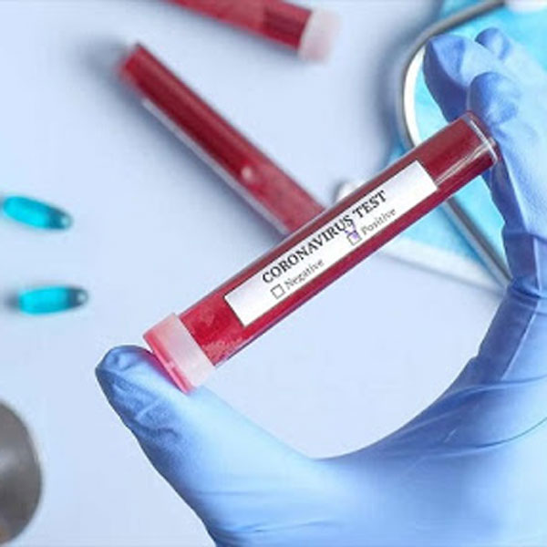 از کجا بفهمیم کرونا گرفته‌ایم؟